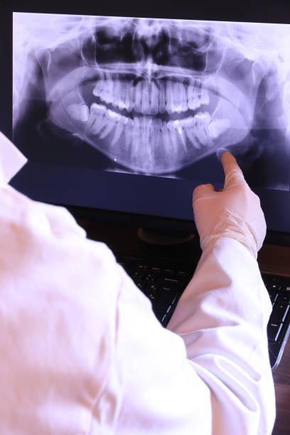 Best Emergency Root Canal Therapy in Mentone, IN