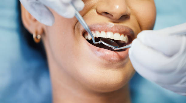 Best Emergency Wisdom Tooth Extraction in Mentone, IN